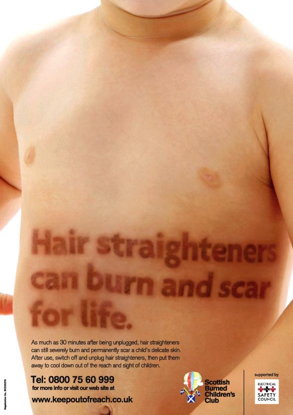 Scottish Burned Children's Club Print Advert By The atom club Hair